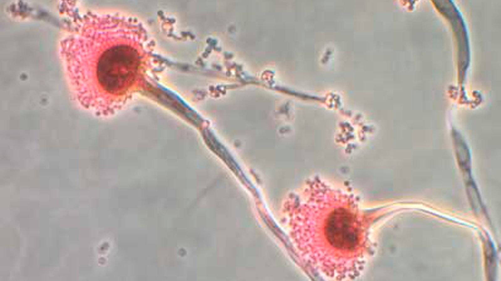 Aspergillus, a type of fungi, is seen in this handout image from the Centres for Disease Control, October 13, 2012. CDC continues to confirm the presence of the fungus Exserohilum in clinical specimens from people with meningitis. At this time, only one clinical specimen has tested positive for the fungus Aspergillus. Pic: Reuters